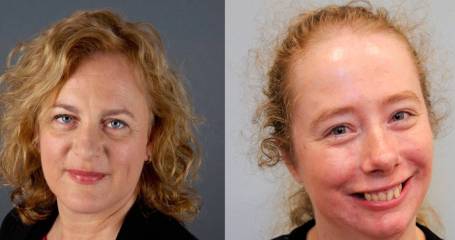 Organisatoren IASSIDD-congres