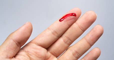 Iemand heeft zich geprikt in z'n vinger